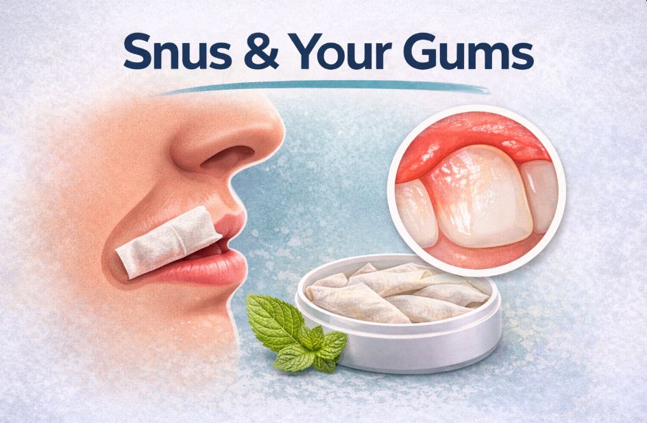 Snus And Your Gums